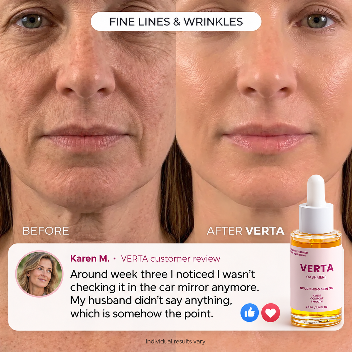 See a firmer, smoother face in just 4 weeks at home.