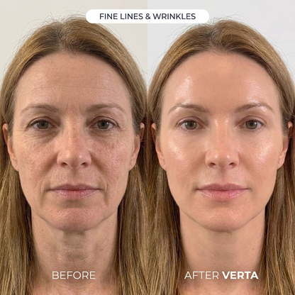 See a firmer, smoother face in just 4 weeks at home.